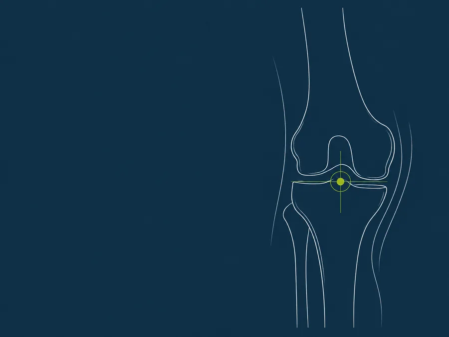 Line illustration of a knee joint with the joint space marked