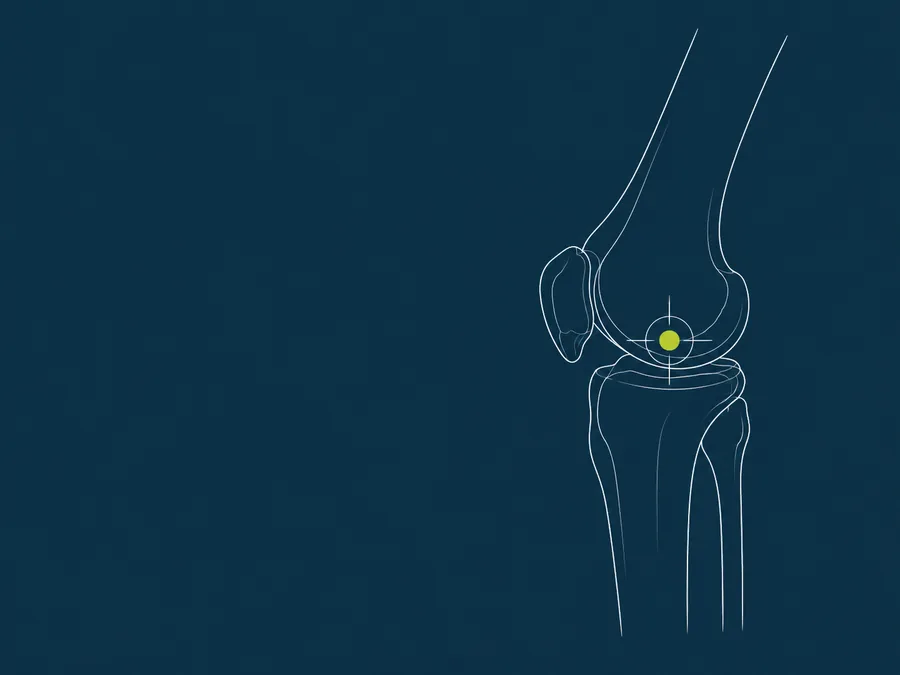 Line illustration of a knee joint with an injection target marked