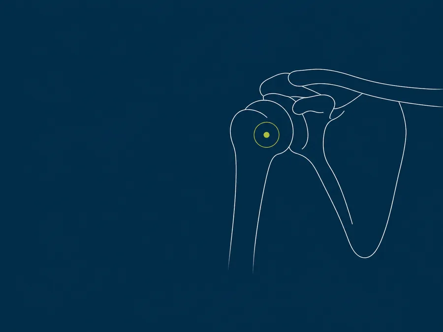 Line illustration of a shoulder joint